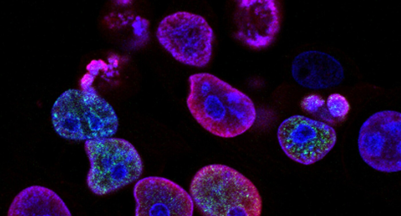 Foundations in Case Investigation and Contact Tracing